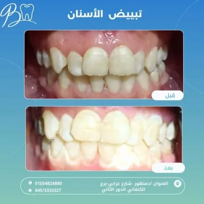مركز دكتور باسم برهام لطب الفم وتقويم و تجميل الأسنان