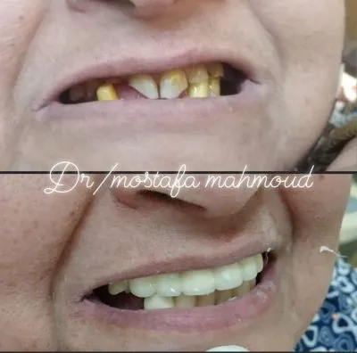 دكتور مصطفى محمود أخصائى طب وجراحة الفم والأسنان