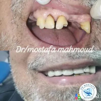 دكتور مصطفى محمود أخصائى طب وجراحة الفم والأسنان