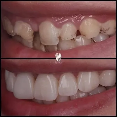 عيادة بيكاسو لطب و تجميل الاسنان دكتور محمد عمر