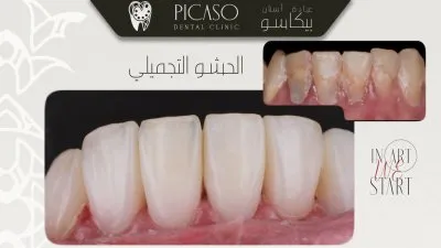 عيادة بيكاسو لطب و تجميل الاسنان دكتور محمد عمر