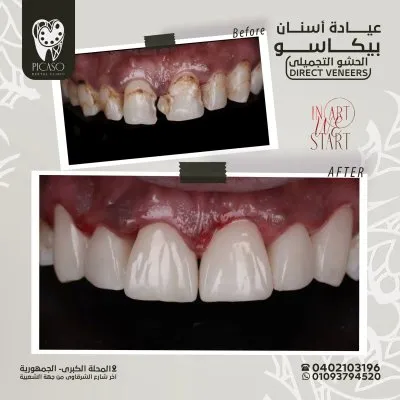 عيادة بيكاسو لطب و تجميل الاسنان دكتور محمد عمر