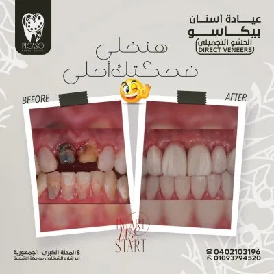 عيادة بيكاسو لطب و تجميل الاسنان دكتور محمد عمر
