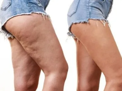 دكتورة  سارة هيكل استشاري التغذية العلاجية و التجميل
