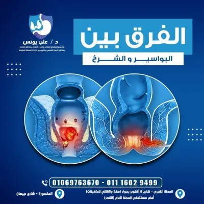 دكتور على يونس استشاري جراحة عامة و مناظير جهاز هضمي
