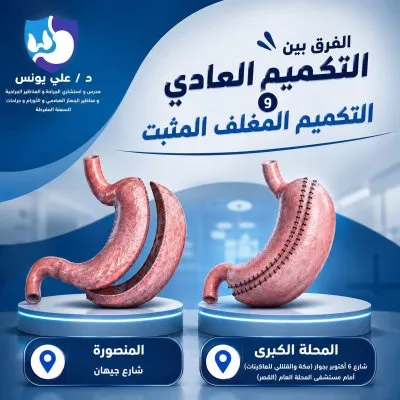 دكتور على يونس استشاري جراحة عامة و مناظير جهاز هضمي