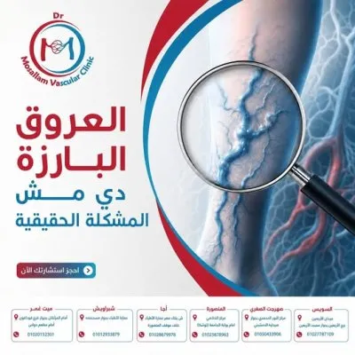 دكتور محمد مسلم دكتوراه جراحة اوعية دموية و قدم سكري