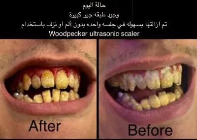 جليم كلينيك لطب الاسنان دكتورة ايمان زكى