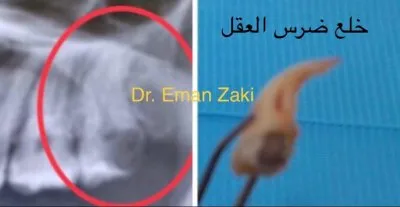 جليم كلينيك لطب الاسنان دكتورة ايمان زكى