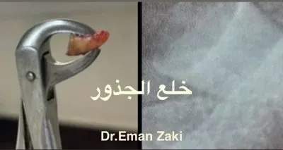 جليم كلينيك لطب الاسنان دكتورة ايمان زكى