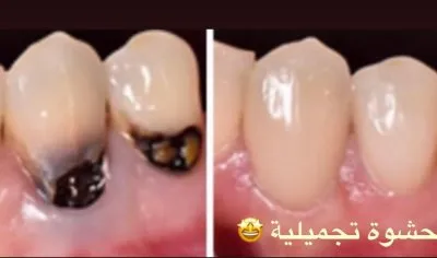 جليم كلينيك لطب الاسنان دكتورة ايمان زكى