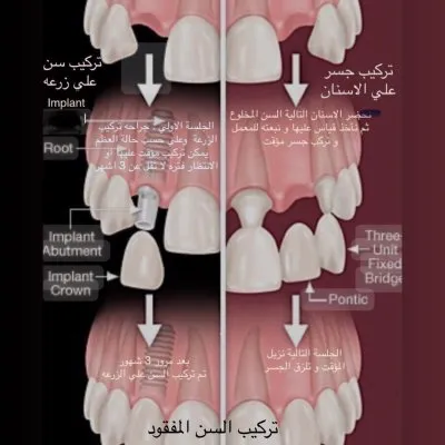 جليم كلينيك لطب الاسنان دكتورة ايمان زكى
