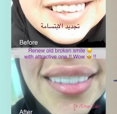 جليم كلينيك لطب الاسنان دكتورة ايمان زكى