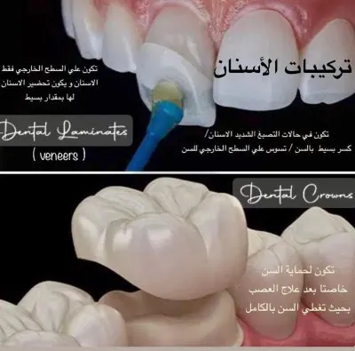 جليم كلينيك لطب الاسنان دكتورة ايمان زكى