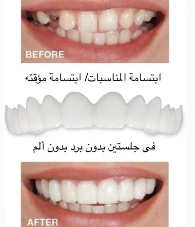 جليم كلينيك لطب الاسنان دكتورة ايمان زكى