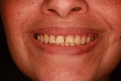 دكتور اسماعيل محمد اخصائي طب الفم و الاسنان