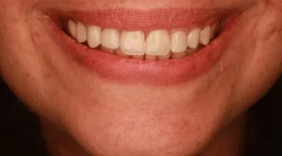 دكتور اسماعيل محمد اخصائي طب الفم و الاسنان