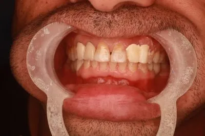 دكتور اسماعيل محمد اخصائي طب الفم و الاسنان