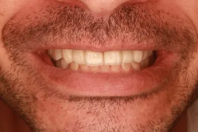 دكتور اسماعيل محمد اخصائي طب الفم و الاسنان