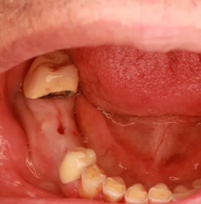 دكتور اسماعيل محمد اخصائي طب الفم و الاسنان