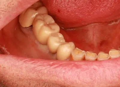 دكتور اسماعيل محمد اخصائي طب الفم و الاسنان