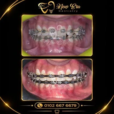 NEW ERA DENTAL CENTER دكتورة شاهنده شعبان لطب الأسنان