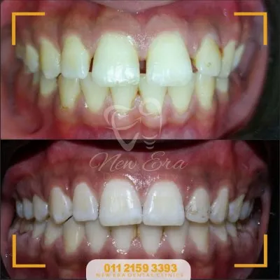 NEW ERA DENTAL CENTER دكتورة شاهنده شعبان لطب الأسنان