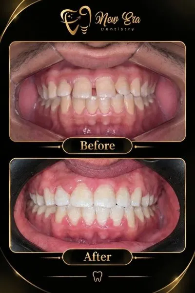 NEW ERA DENTAL CENTER دكتورة شاهنده شعبان لطب الأسنان