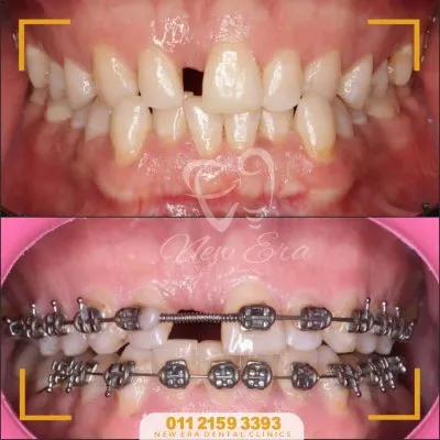 NEW ERA DENTAL CENTER دكتورة شاهنده شعبان لطب الأسنان