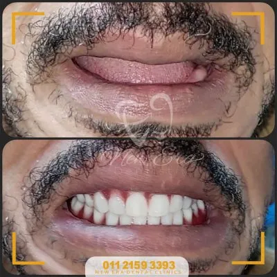 NEW ERA DENTAL CENTER دكتورة شاهنده شعبان لطب الأسنان