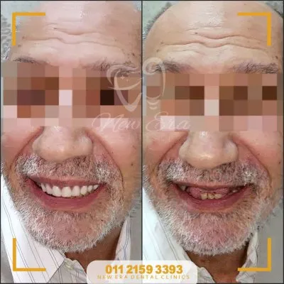 NEW ERA DENTAL CENTER دكتورة شاهنده شعبان لطب الأسنان