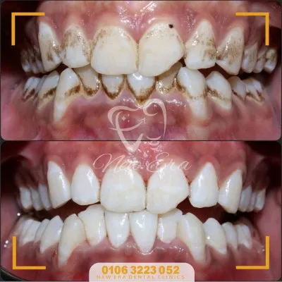 NEW ERA DENTAL CENTER دكتورة شاهنده شعبان لطب الأسنان