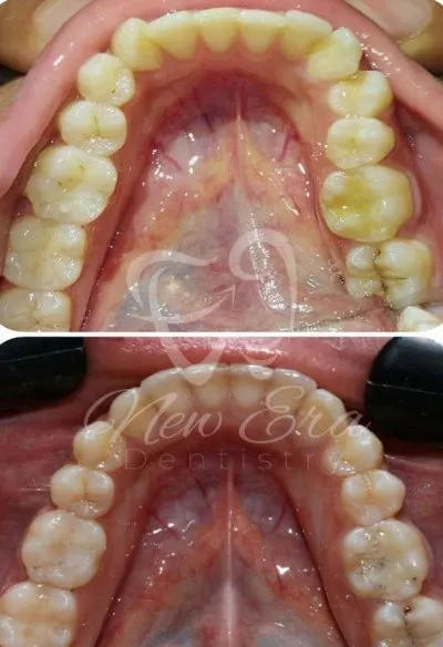 NEW ERA DENTAL CENTER دكتورة شاهنده شعبان لطب الأسنان