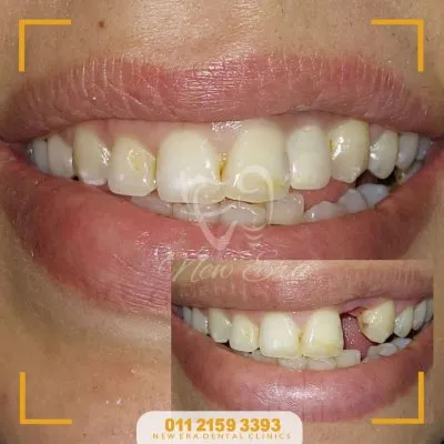 NEW ERA DENTAL CENTER دكتورة شاهنده شعبان لطب الأسنان