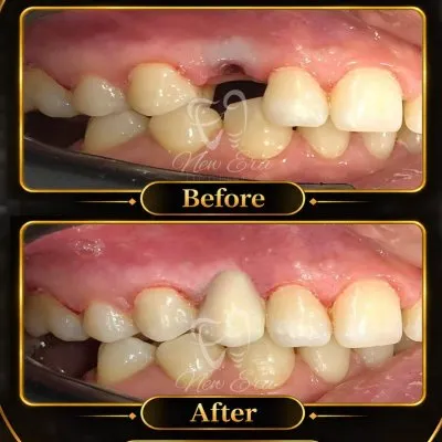 NEW ERA DENTAL CENTER دكتورة شاهنده شعبان لطب الأسنان