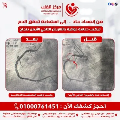 مركز دكتور محمود جلال عطاالله لأمراض القلب