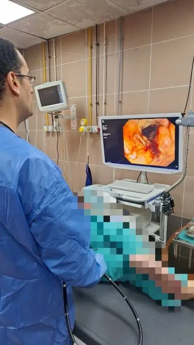 الدكتور محمد أبواليزيد أبو العزم أخصائي الكبد والجهاز الهضمي والمناظير