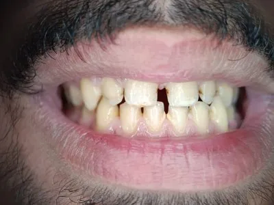 دكتورة مى محمد ابو زيد ماجيستير تركيبات ثابتة