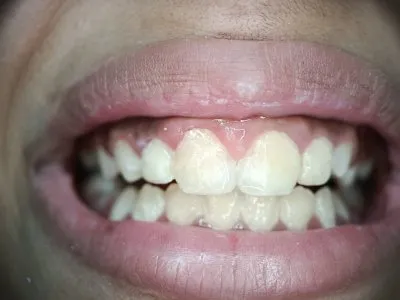دكتورة مى محمد ابو زيد ماجيستير تركيبات ثابتة