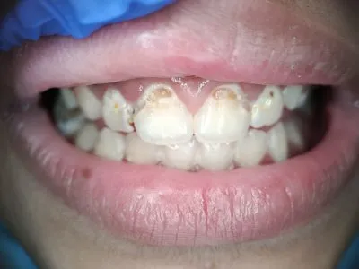 دكتورة مى محمد ابو زيد ماجيستير تركيبات ثابتة