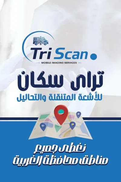 تراي سكان للأشعة المتنقلة والتحاليل