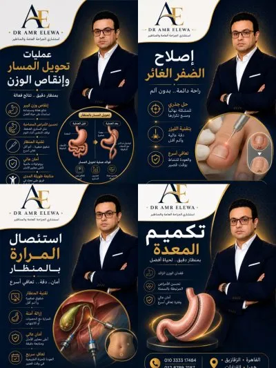 دكتورعمرو عليوة المسلمي استشاري الجراحة العامة والأورام والمناظير