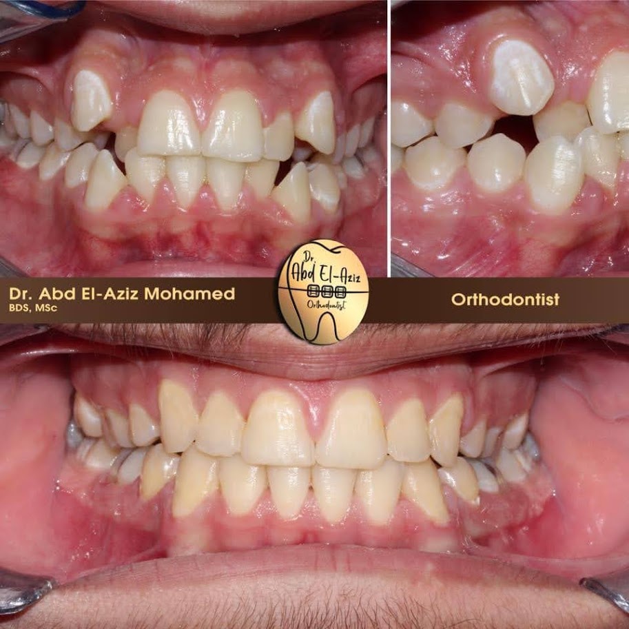 د/ عبد العزيز محمد اخصائى تقويم الاسنان