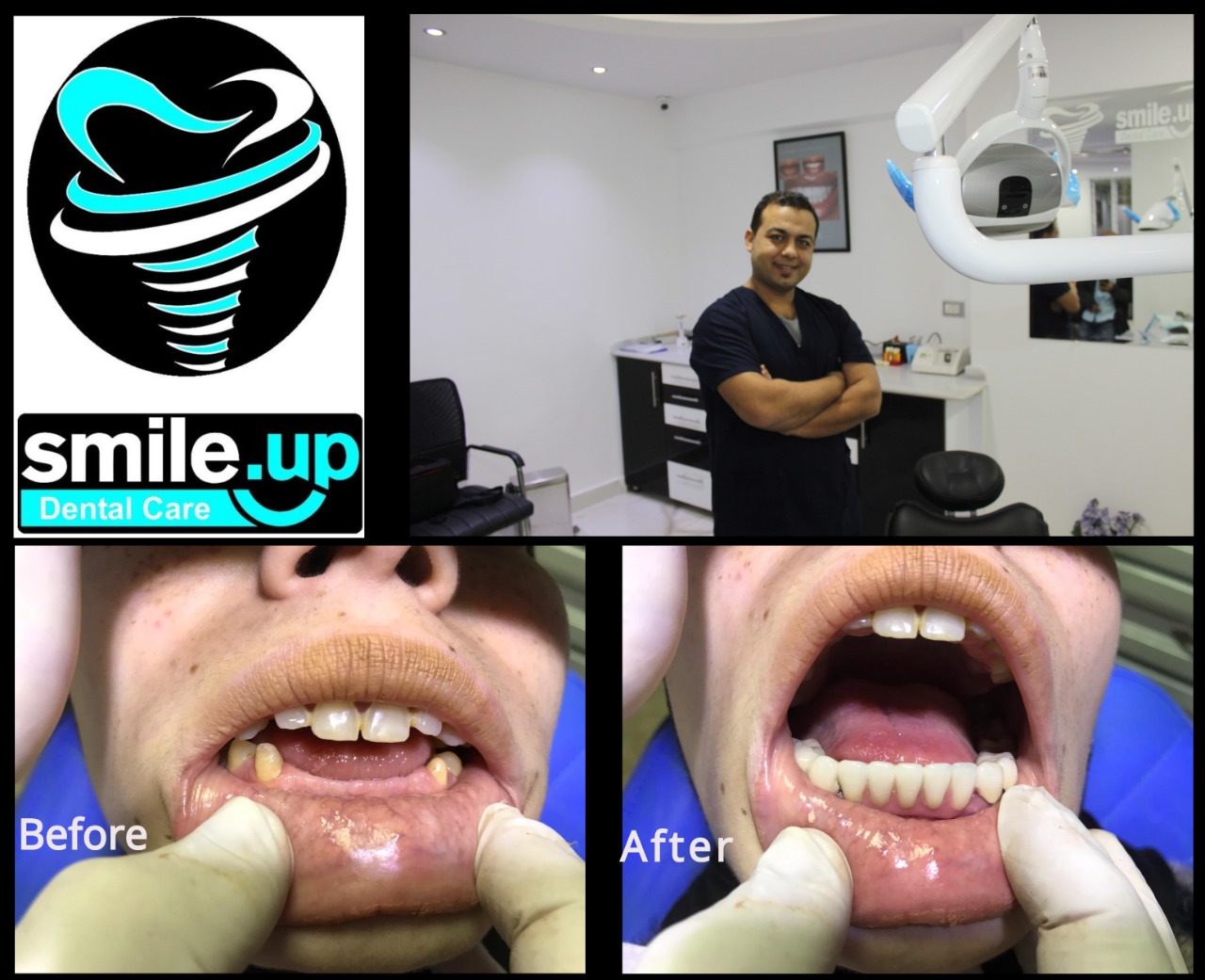 smile up dental care دكتور أحمد السيد رجب أخصائى طب وجراحة الفم والأسنان