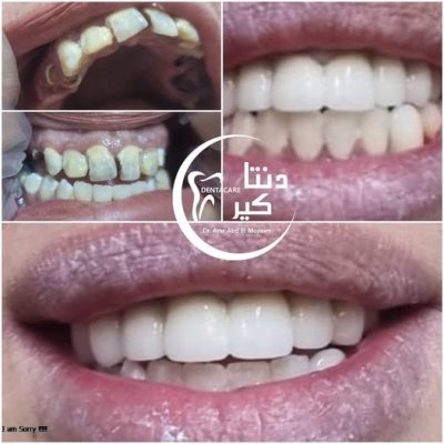 دنتا كير  دكتور عمرو محمد عبد المنعم  أخصائى طب وجراحة الفم والأسنان