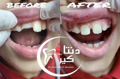 دنتا كير  دكتور عمرو محمد عبد المنعم  أخصائى طب وجراحة الفم والأسنان