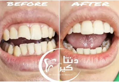 دنتا كير  دكتور عمرو محمد عبد المنعم  أخصائى طب وجراحة الفم والأسنان