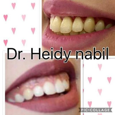 دكتورة هايدي نبيل صبحى إستشاري جراحة الفم وغرس الأسنان