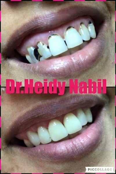 دكتورة هايدي نبيل صبحى إستشاري جراحة الفم وغرس الأسنان