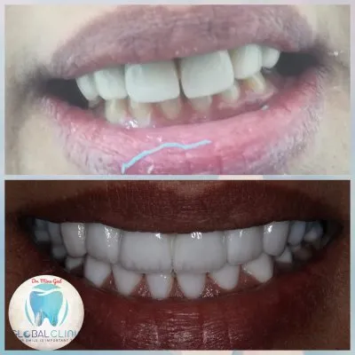 دكتور مينا جاد اخصائى طب و جراحة الفم و زراعة الاسنان